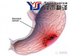 医学翻译：消化科——胃癌